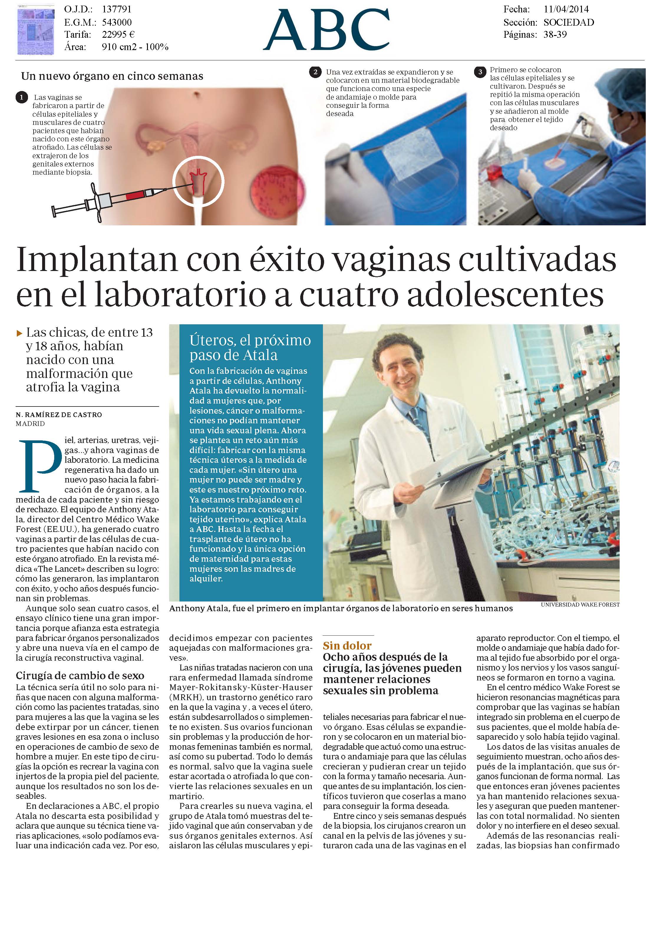 Implantan con éxito vaginas cultivadas en el laboratorio a cuatro  adolescentes. Educación sexual - SIDA STUDI